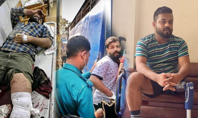 পা হারানো সেই সাইফই এখন চট্টগ্রামের রাজনীতিতে আলোচিত মুখ